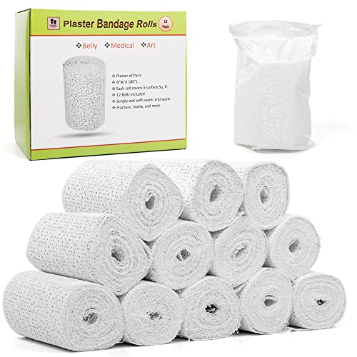 Noe & Malu 4-Inch x 15-Foot Fast-Setting Plaster of Paris Rolls, 12-Pack